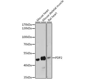 Western Blot - Anti-PDP2 Antibody (A93290) - Antibodies.com