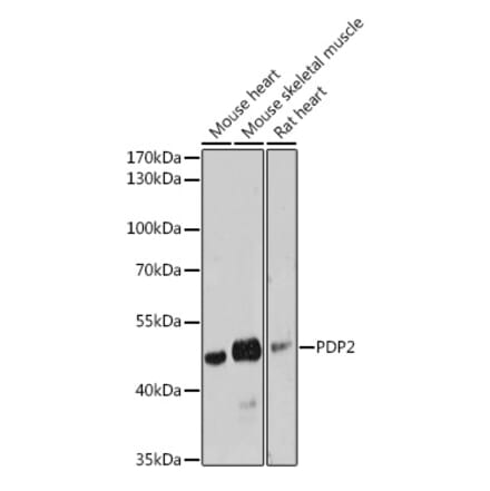 Western Blot - Anti-PDP2 Antibody (A93290) - Antibodies.com