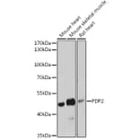 Western Blot - Anti-PDP2 Antibody (A93290) - Antibodies.com