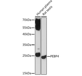 Western Blot - Anti-Pebp4 Antibody (A93291) - Antibodies.com