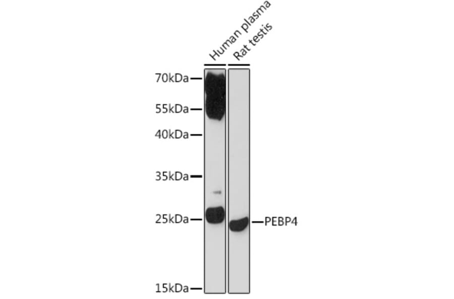 Western Blot - Anti-Pebp4 Antibody (A93291) - Antibodies.com
