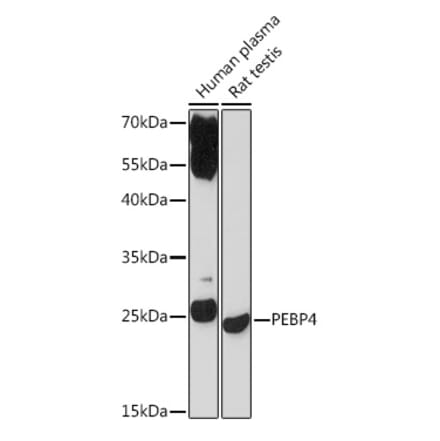 Western Blot - Anti-Pebp4 Antibody (A93291) - Antibodies.com