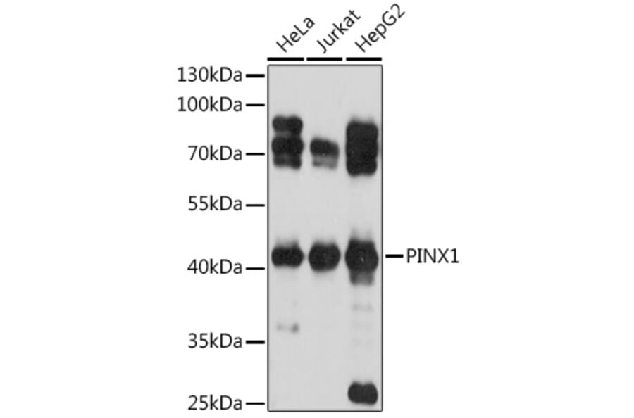Western Blot - Anti-PINX1/LPTS Antibody (A93294) - Antibodies.com