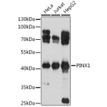 Western Blot - Anti-PINX1/LPTS Antibody (A93294) - Antibodies.com
