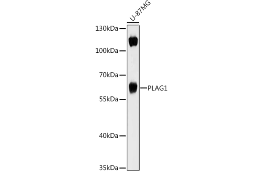 Western Blot - Anti-PLAG1 Antibody (A93295) - Antibodies.com