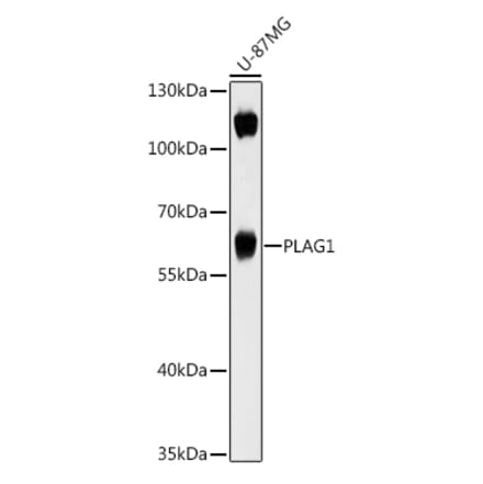 Western Blot - Anti-PLAG1 Antibody (A93295) - Antibodies.com