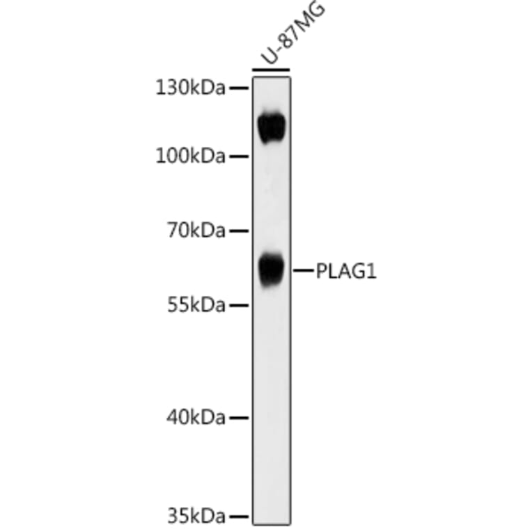 Western Blot - Anti-PLAG1 Antibody (A93295) - Antibodies.com