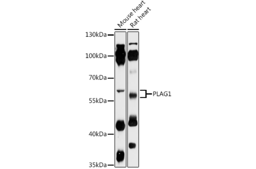 Western Blot - Anti-PLAG1 Antibody (A93295) - Antibodies.com