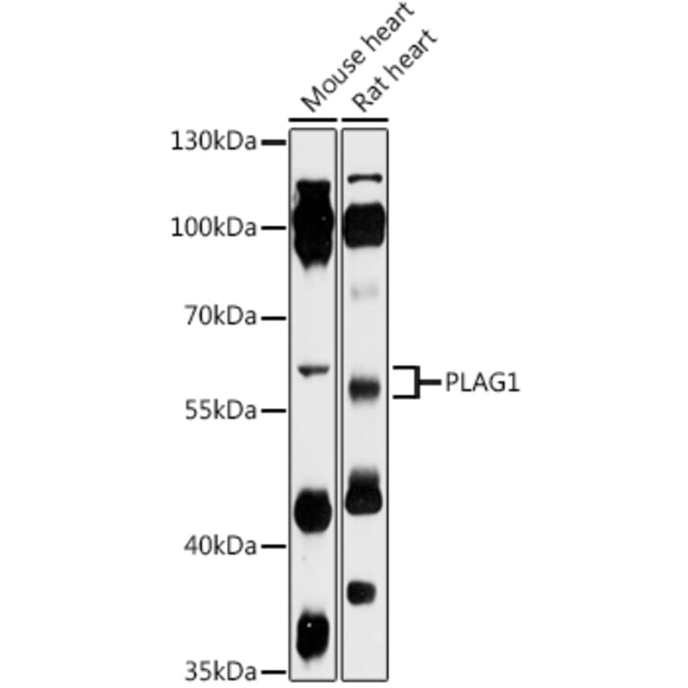 Western Blot - Anti-PLAG1 Antibody (A93295) - Antibodies.com