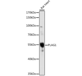 Western Blot - Anti-PLAG1 Antibody (A93296) - Antibodies.com