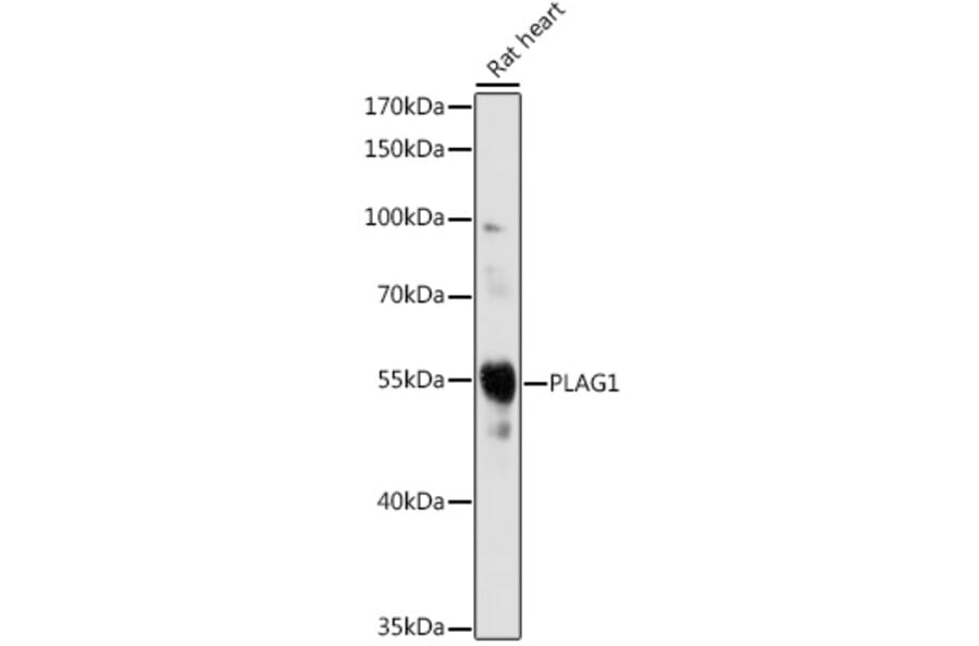 Western Blot - Anti-PLAG1 Antibody (A93296) - Antibodies.com