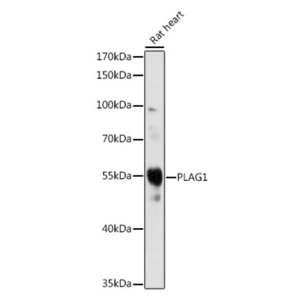 Western Blot - Anti-PLAG1 Antibody (A93296) - Antibodies.com