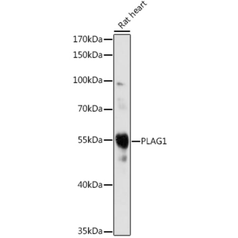 Western Blot - Anti-PLAG1 Antibody (A93296) - Antibodies.com