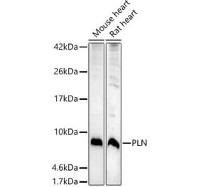 Western Blot - Anti-Phospholamban Antibody (A93297) - Antibodies.com