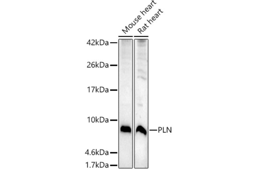 Western Blot - Anti-Phospholamban Antibody (A93297) - Antibodies.com
