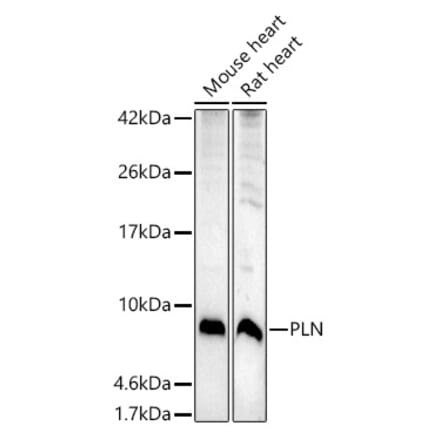 Western Blot - Anti-Phospholamban Antibody (A93297) - Antibodies.com