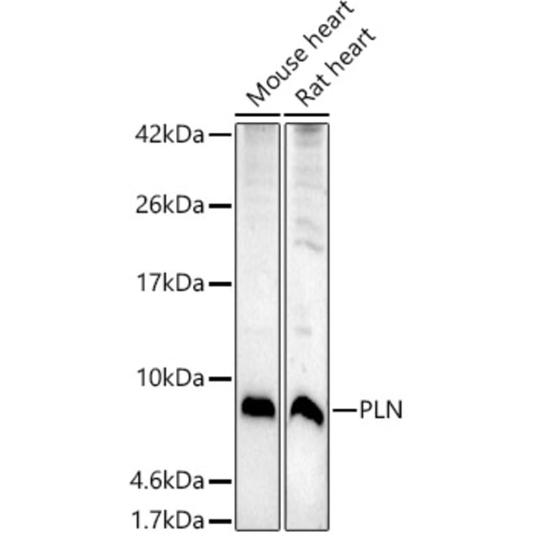 Western Blot - Anti-Phospholamban Antibody (A93297) - Antibodies.com