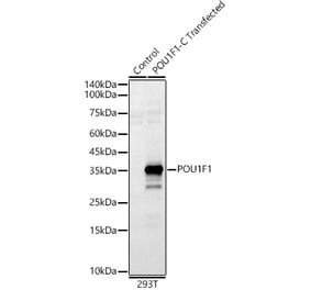 Western Blot - Anti-Pit1 Antibody (A93298) - Antibodies.com