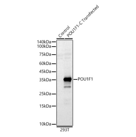 Western Blot - Anti-Pit1 Antibody (A93298) - Antibodies.com