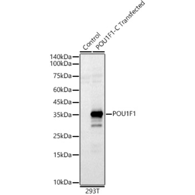 Western Blot - Anti-Pit1 Antibody (A93298) - Antibodies.com