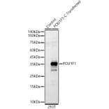 Western Blot - Anti-Pit1 Antibody (A93298) - Antibodies.com