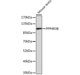 Western Blot - Anti-SMEK2 Antibody (A93300) - Antibodies.com