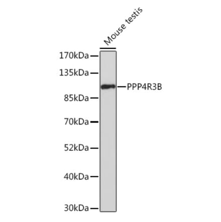 Western Blot - Anti-SMEK2 Antibody (A93300) - Antibodies.com