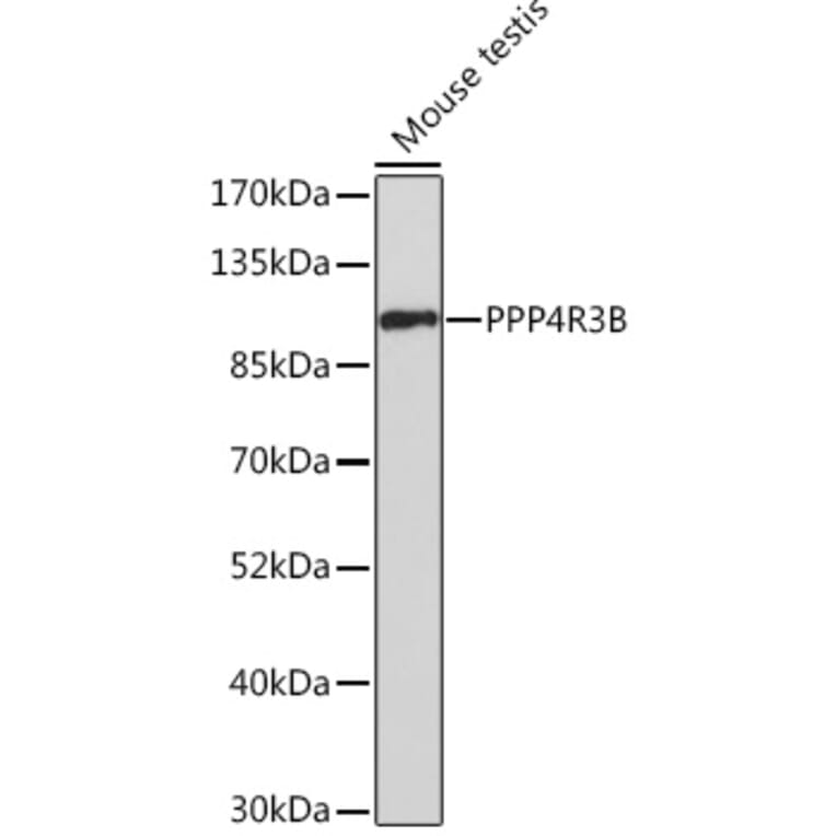 Western Blot - Anti-SMEK2 Antibody (A93300) - Antibodies.com