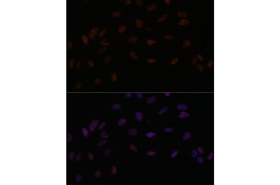 Immunofluorescence - Anti-SMEK2 Antibody (A93300) - Antibodies.com