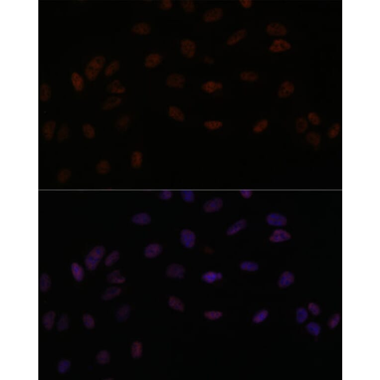 Immunofluorescence - Anti-SMEK2 Antibody (A93300) - Antibodies.com