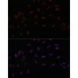 Immunofluorescence - Anti-SMEK2 Antibody (A93300) - Antibodies.com