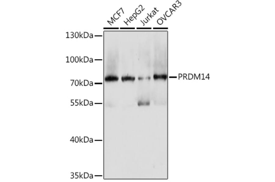 Western Blot - Anti-PRDM14 Antibody (A93301) - Antibodies.com