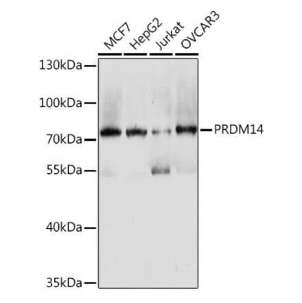 Western Blot - Anti-PRDM14 Antibody (A93301) - Antibodies.com
