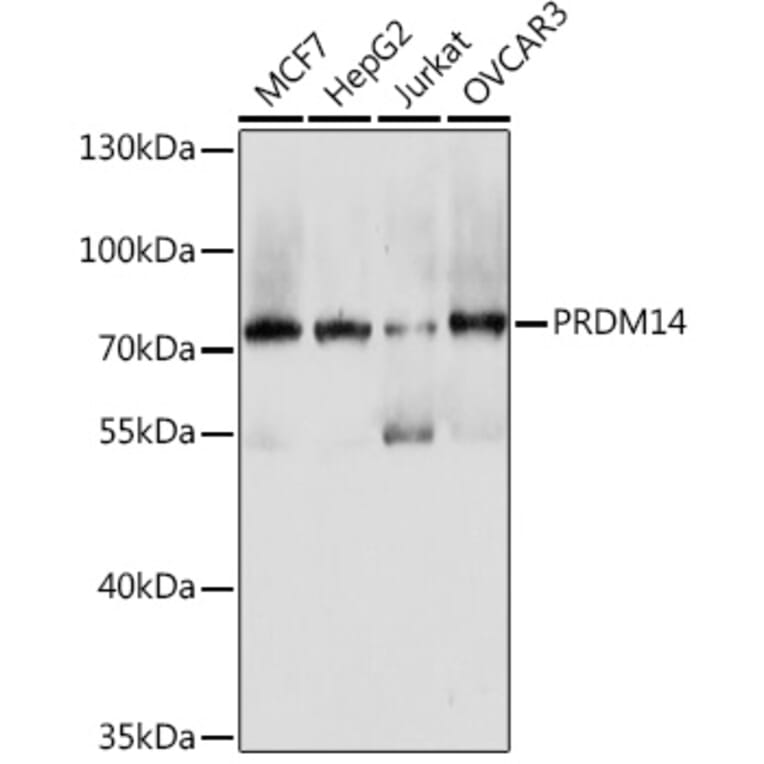 Western Blot - Anti-PRDM14 Antibody (A93301) - Antibodies.com