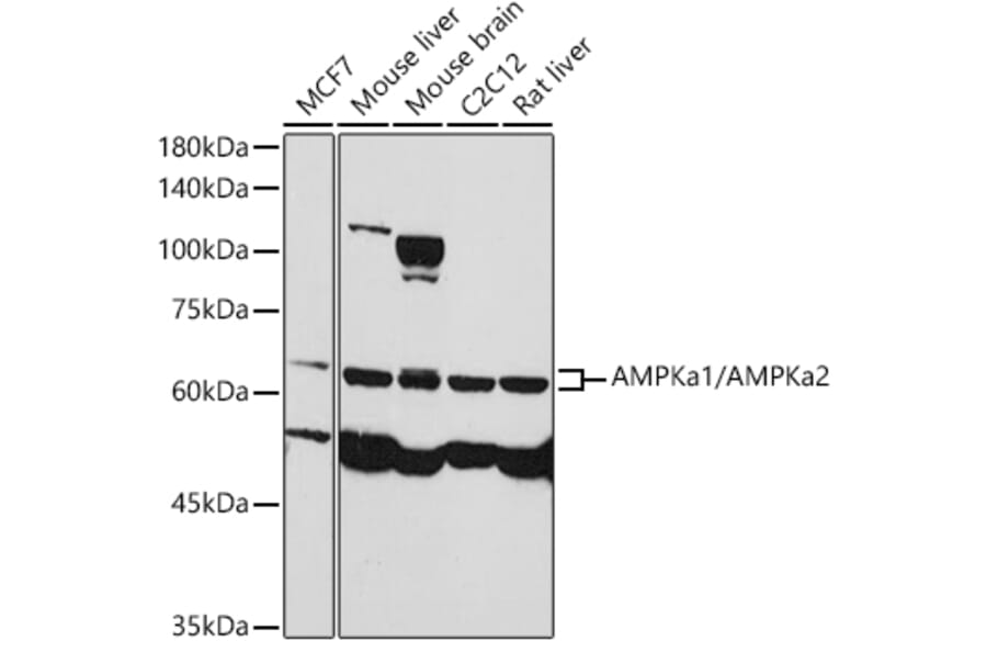 Western Blot - Anti-AMPK alpha 1 +AMPK alpha 2 Antibody (A93304) - Antibodies.com