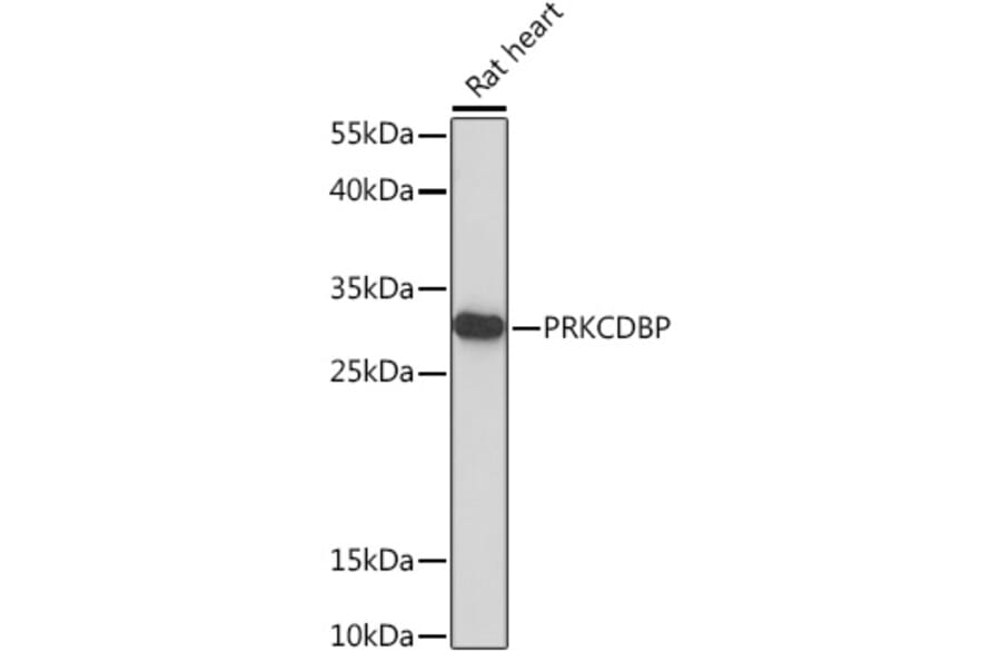 Western Blot - Anti-SRBC Antibody (A93306) - Antibodies.com