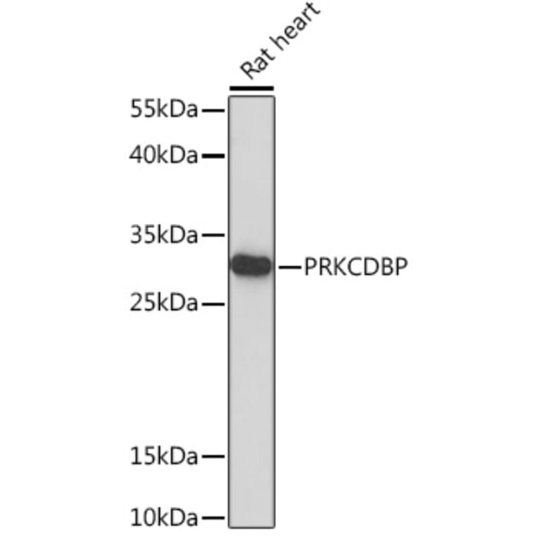 Western Blot - Anti-SRBC Antibody (A93306) - Antibodies.com