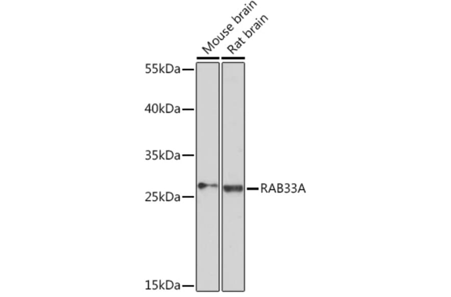 Western Blot - Anti-RAB33A Antibody (A93308) - Antibodies.com