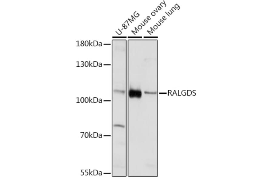 Western Blot - Anti-RALGDS Antibody (A93309) - Antibodies.com