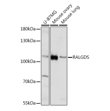 Western Blot - Anti-RALGDS Antibody (A93309) - Antibodies.com