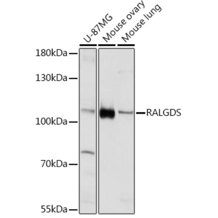 Western Blot - Anti-RALGDS Antibody (A93309) - Antibodies.com