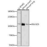 Western Blot - Anti-RALGDS Antibody (A93309) - Antibodies.com