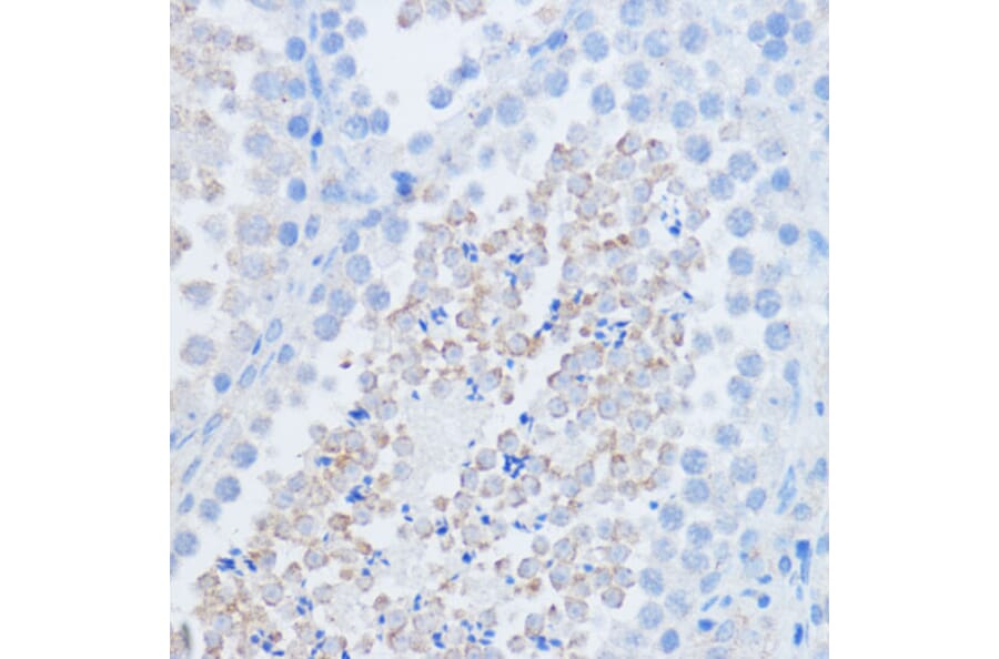 Immunohistochemistry - Anti-RALGDS Antibody (A93309) - Antibodies.com