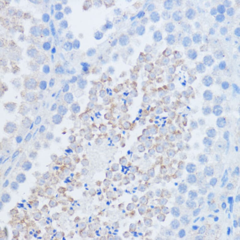 Immunohistochemistry - Anti-RALGDS Antibody (A93309) - Antibodies.com