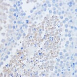 Immunohistochemistry - Anti-RALGDS Antibody (A93309) - Antibodies.com