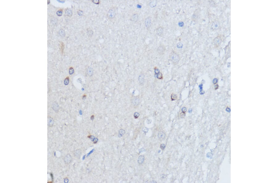 Immunohistochemistry - Anti-RALGDS Antibody (A93309) - Antibodies.com
