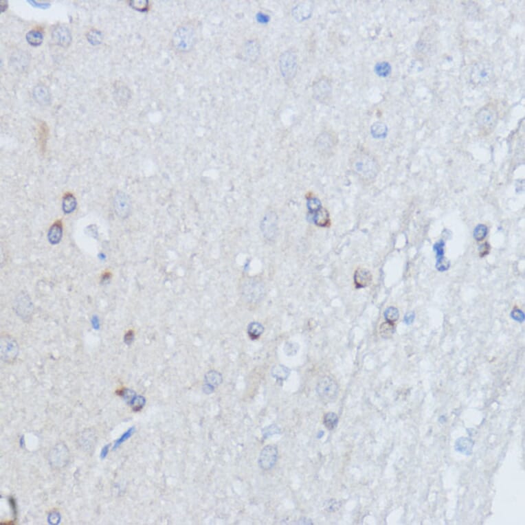 Immunohistochemistry - Anti-RALGDS Antibody (A93309) - Antibodies.com