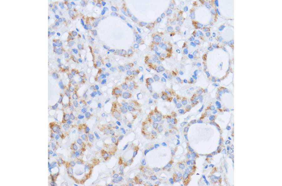 Immunohistochemistry - Anti-RALGDS Antibody (A93309) - Antibodies.com