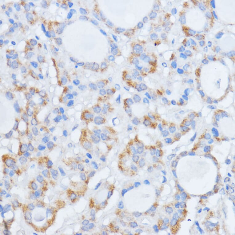 Immunohistochemistry - Anti-RALGDS Antibody (A93309) - Antibodies.com