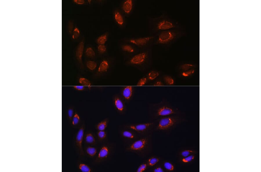 Immunofluorescence - Anti-RALGDS Antibody (A93309) - Antibodies.com